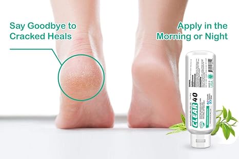 Clear 40, 40% Urea Gel, 8 oz w/Tea Tree & Coconut Oil