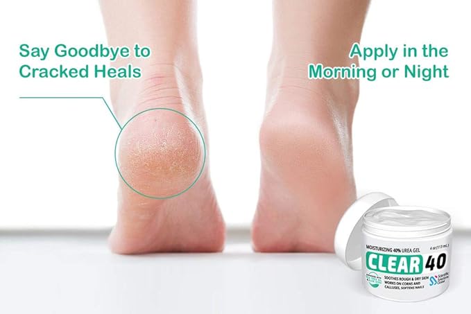 CLEAR 40 - 40% Urea Gel with Tea Tree Oil and Aloe Vera