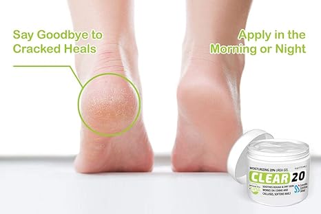 CLEAR 20, 20% Urea Gel, 4 oz w/ Tea Tree & Coconut Oil, Aloe Vera Extract